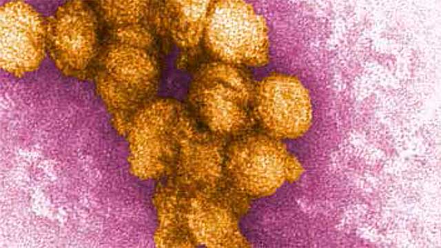 virus-nilo-occidental-particulas