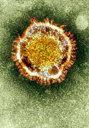 coronavirus